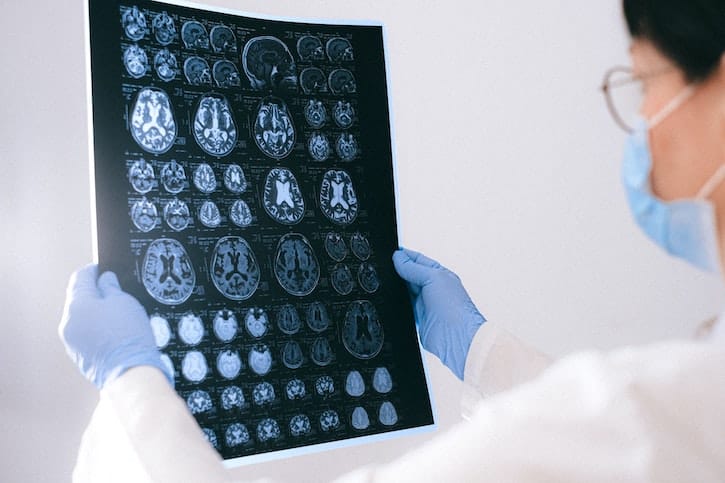 Doctor examining a brain scan at drug and alcohol rehab in Cheshire or near Cheshire