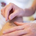 acupuncture for addiction treatment